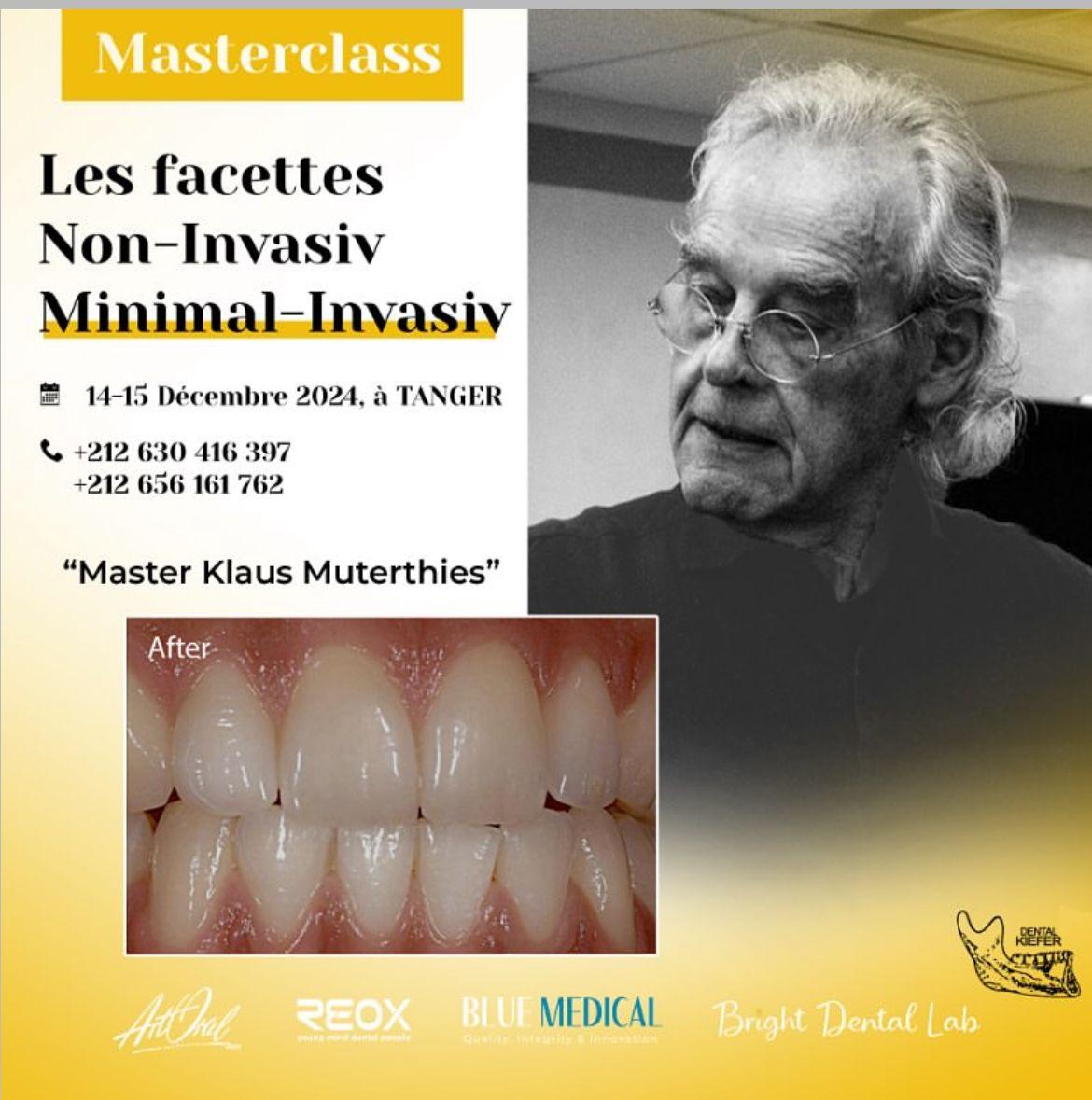 Masterclass: Non-Invasive / Minimal-Invasive Veneers